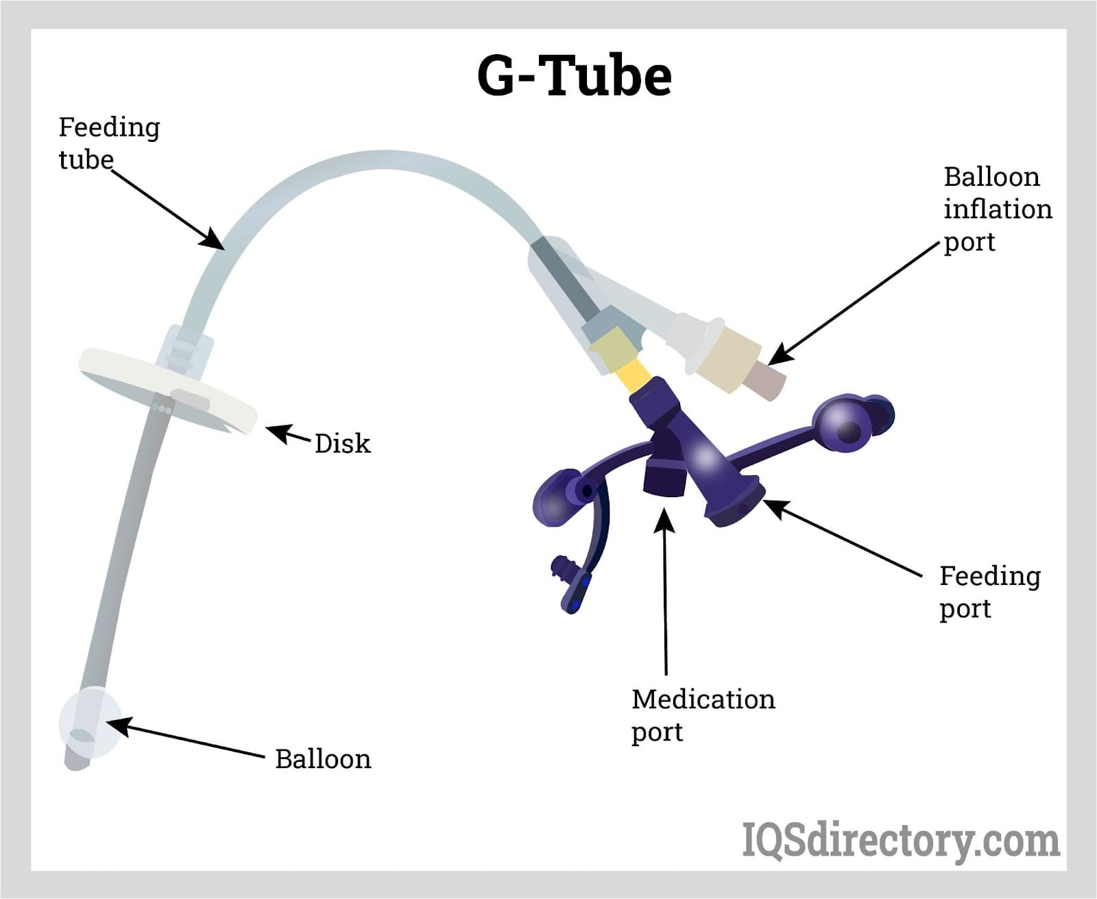 G-Tube